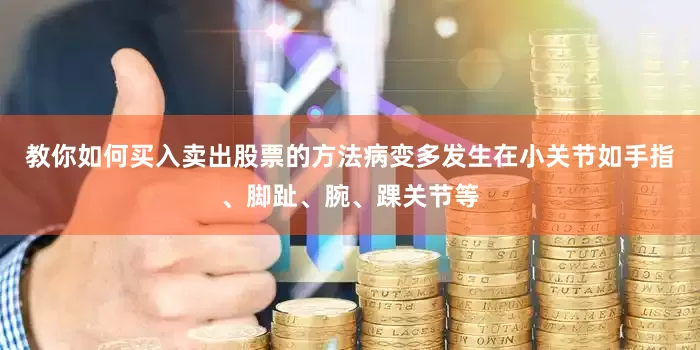 教你如何买入卖出股票的方法病变多发生在小关节如手指、脚趾、腕、踝关节等